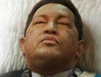 Chavez öldü Chavez öldü