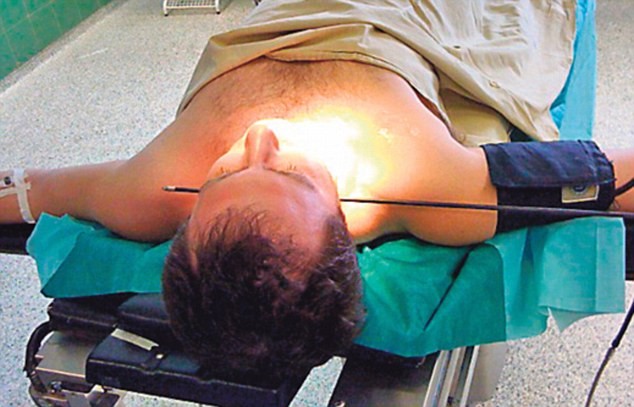 50 Santimlik Ok Saplandı