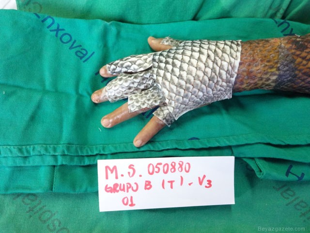 Tıp tarihinde bir ilki gerçekleştirdiler