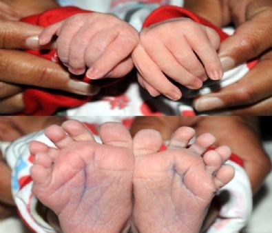 yeni dogan bebek - Suriyeli bebek '24 parmaklı' doğdu