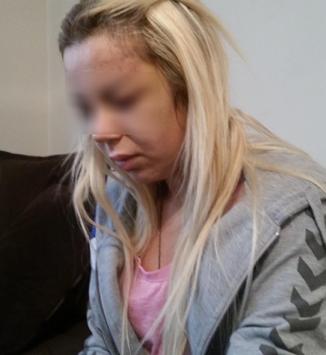 Güne Damga Vuran Şiddet Mağduru Kadın Konuştu