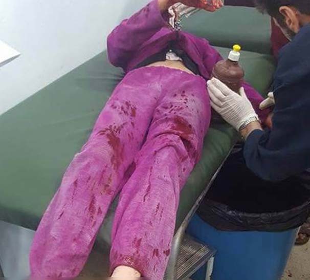 PKK, Mare'de sivilleri vurdu