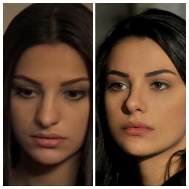 Ünlülerin büyük değişimi