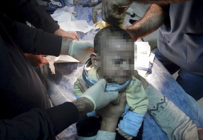 Oynadığı Darbukaya Kafası Sıkıştı