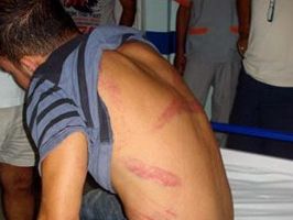 DAVUTPAŞA - Öğrencisini hastanelik etti