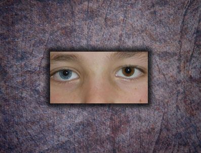 İHSAN KESKIN - Bir gözü mavi bir gözü kahverengi