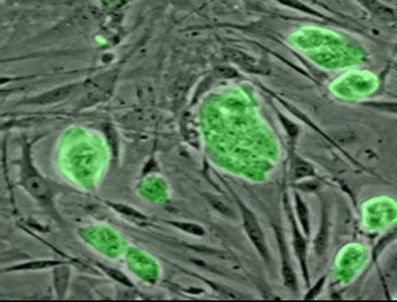 ATLANTA - Dünyada bir ilk!