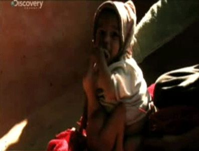 İHTIMAL - Ahtapot çocuk ameliyat oldu