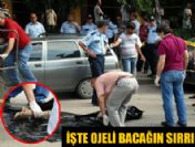 Çöpteki ojeli bacağın sırrı çözüldü