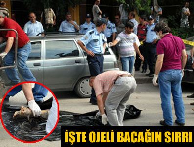 Çöpteki ojeli bacağın sırrı çözüldü