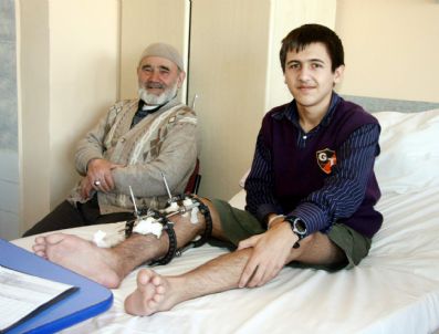 SIVAS CUMHURIYET ÜNIVERSITESI - Sivas'ta 15 Yaşındaki Çocuğun Bacağı 6 Santim Uzatıldı