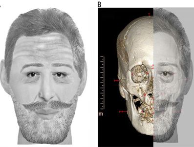 4. Henri'nin kesik kafası teşhis edildi