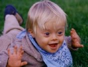 Down Sendromu bir kalıtımsal bir hastalık mıdır?