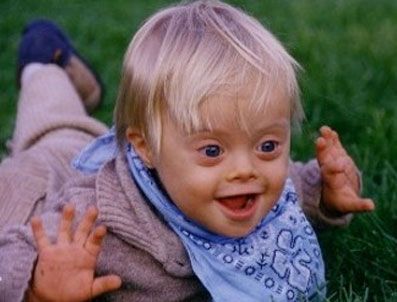 KROMOZOM - Down Sendromu nedir? (Üniversitelilerden eğitim)