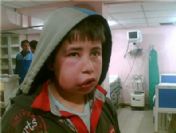 Lastik Yakarak Oyun Oynadıklarını Öne Süren Çocuklara Polis Dayağı İddiası