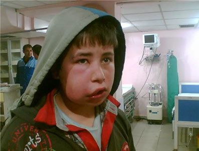 Lastik Yakarak Oyun Oynadıklarını Öne Süren Çocuklara Polis Dayağı İddiası