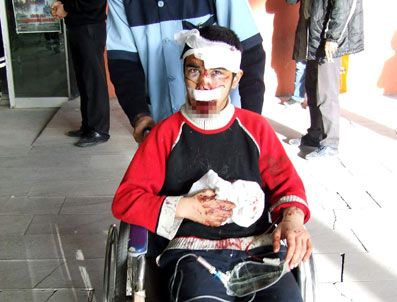 ŞAHINBEY ARAŞTıRMA VE UYGULAMA HASTANESI - Bisikletten Düşen Çocuk Ağır Yaralandı