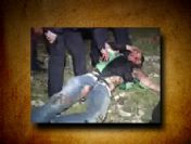 Vücudu yandı 300 metre ambulansa yürütüldü