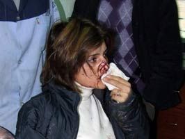 Sivas'ta Trafik Kazası: 7 Yaralı