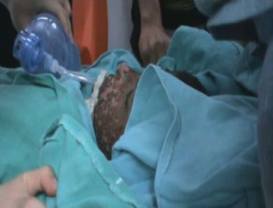 Kolej Laboratuvarında Patlama: 6 Yaralı