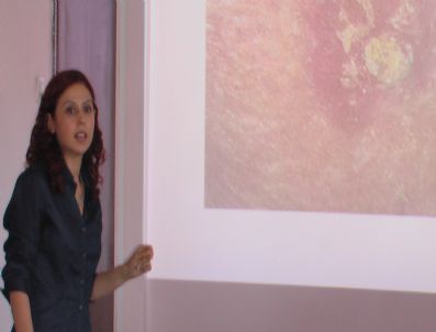 MUSA USLAN - Cilt Kanserinde Artış