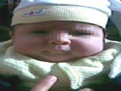 Sünnet Olan Çocuğun Penisinden Olduğu İddiası