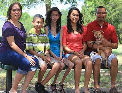 21 yaşındaki kız , onbeş dakikada bir yemek yese de sadece 25 kg.