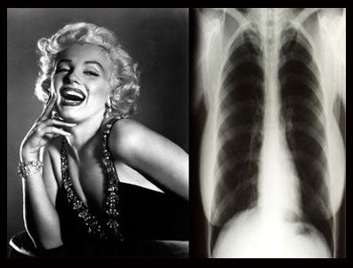 Marilyn Monroe'nun röntgenlerini sattı