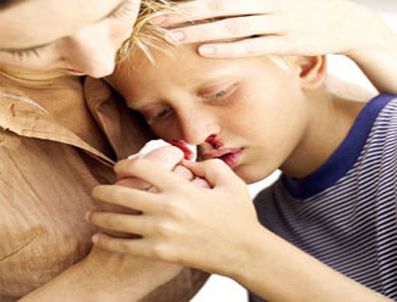 Burun kanaması hangi durumlarda tehlikelidir?