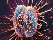 Bilecik'te kanser taraması: 63 vaka tespit edildi