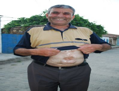 Öldü Diye Ameliyatı Yarım Bırakılan Şahıs, 15 Yıldır Yaşıyor