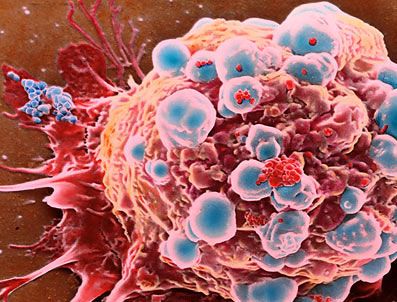 FIZYOLOJI - Kanserli hücre intihar ediyor