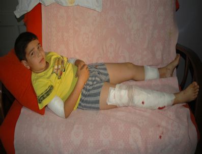 MEHMET PARLAK - Eğitimli Köpek Çocuğa Saldırdı