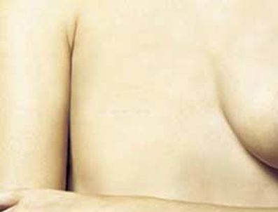 Meme kanserini önlemede yürüyüşün önemi