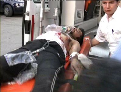 MERSIN ÜNIVERSITESI - Mersin'de Silahlı Kavga: 3 Yaralı