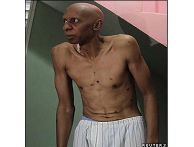 Kübalı muhalif açlık grevini sonlandırdı