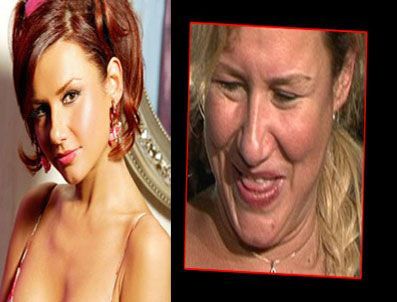 DENİZ SEKİ - Deniz Seki'yi gören tanıyamıyor