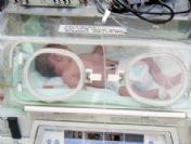 Böbrek Yetmezliği Olan 9 Günlük Bebek Uçak Ambulansla Sevk Edildi