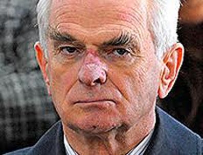 YıLMAZ ATEŞ - Hakkı Süha Okay'ın gömleğini sildi