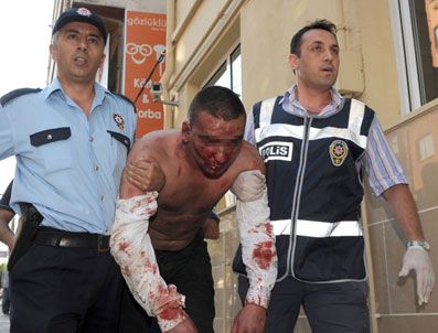 Akın Birdal'a kafa atan saldırganın Batman sırrı