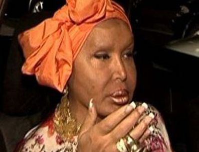 PICASSO - Bülent Ersoy kaşlarını neden kazıttı