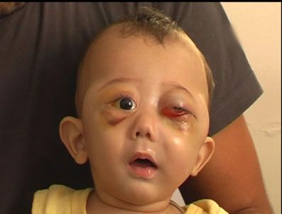 Talihsiz bebeği bu hale annesi getirdi