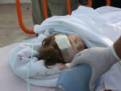 Berinay Hayatta Kalma Mücadelesini Kaybetti