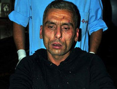 Korna çalan taksici komalık oldu