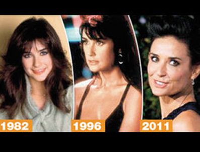 DEMİ MOORE - Demi Moore'un yüzü 'düşecek hale' geldi