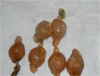 CARLOS ALBERTO - Bağırsakları düğümlenince ölümden döndü