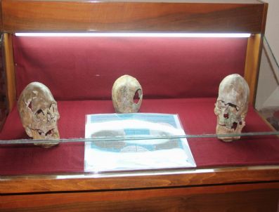 4500 Yıllık Ameliyatlı Kafatasları