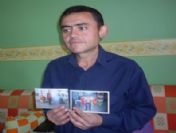 Kırıkkale`de 140 Kilogram Ağırlığındaki Bir Vatandaş Geçirdiği Ameliyatla 85 Kilo Birden Verdi