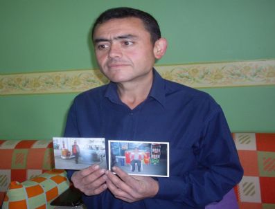 Kırıkkale`de 140 Kilogram Ağırlığındaki Bir Vatandaş Geçirdiği Ameliyatla 85 Kilo Birden Verdi