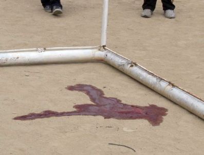 Başına Kale Direği Düşen Çocuk Hayatını Kaybetti